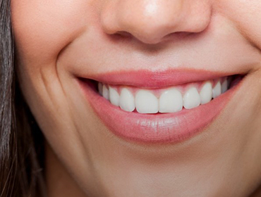 Cosmetic dentistry